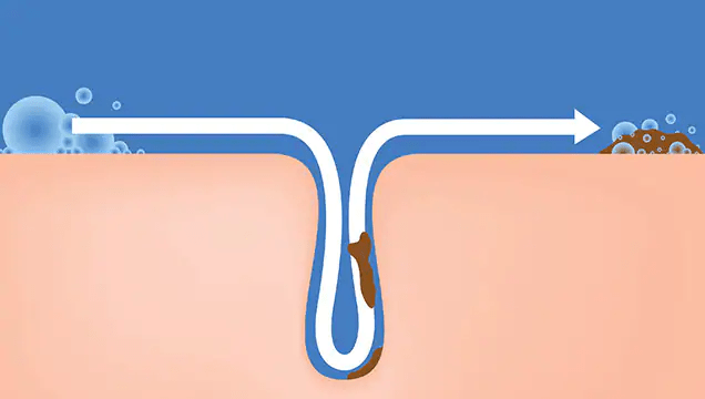 черни точки